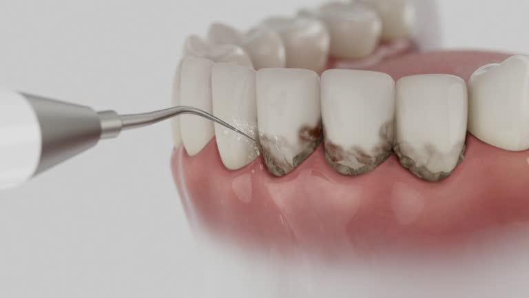 Trusted Dental Implants service in Fearrington Village, NC - Dentist Open Now